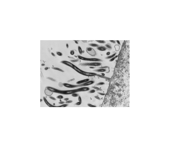 ￼
Click here for information on the paper Spirochete Attachment Ultrastructure: Implications for the Origin and Evolution of Cilia 

